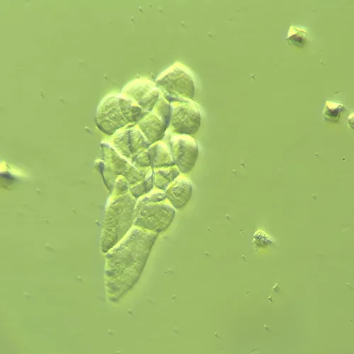 foto Zařízení pro práci s Hoffmanovou modulovanou kontrastní metodou MAGUS HCM360, se sadou objektivů,  14