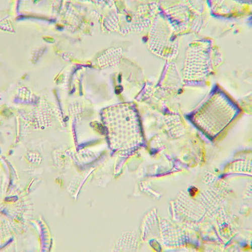 fotografie Biologický digitální mikroskop MAGUS Bio D290T LCD,  32