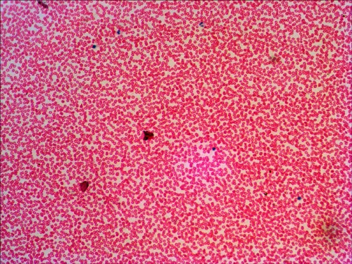snímek Sada preparátů připravených k pozorování mikroskopem Levenhuk N38 NG,  16
