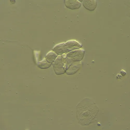 foto Zařízení pro práci s Hoffmanovou modulovanou kontrastní metodou MAGUS HCM360, se sadou objektivů,  13